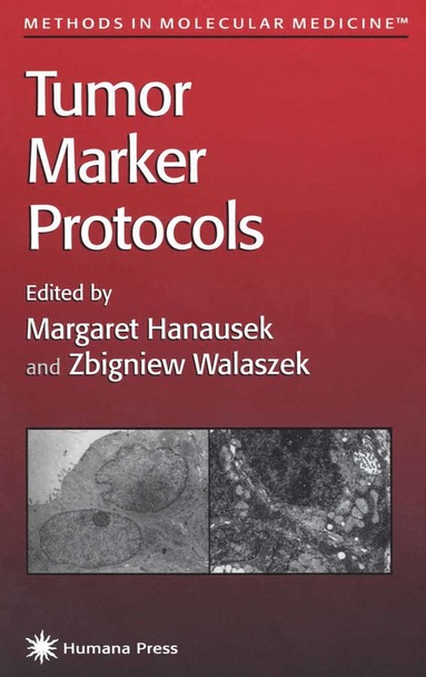 bokomslag Tumor Marker Protocols