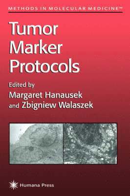Tumor Marker Protocols 1