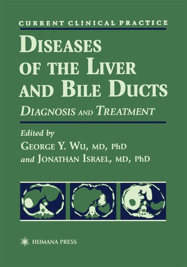 George Y. Wu - Diseases of the Liver and Bile Ducts, Inbunden
