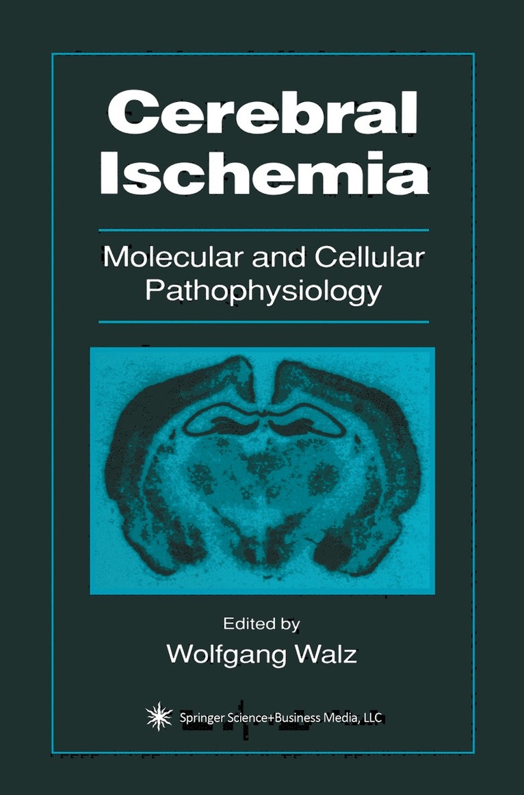 Cerebral Ischemia 1