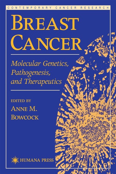 Anne M. Bowcock - Breast Cancer, Inbunden