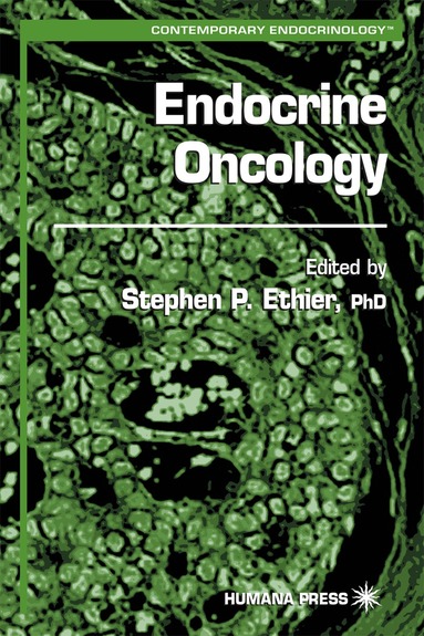 Stephen P. Ethier, Stephen P. Ethier - Endocrine Oncology, Inbunden