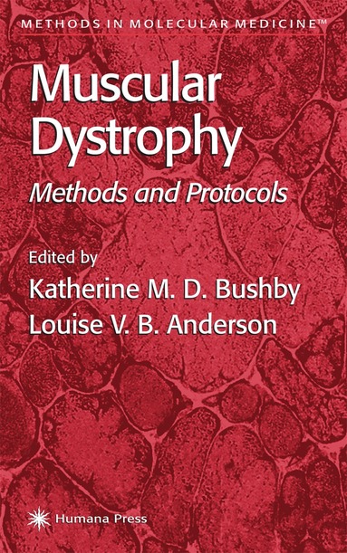 Katherine M.D. Bushby, Louise V.B. Anderson - Muscular Dystrophy, Inbunden