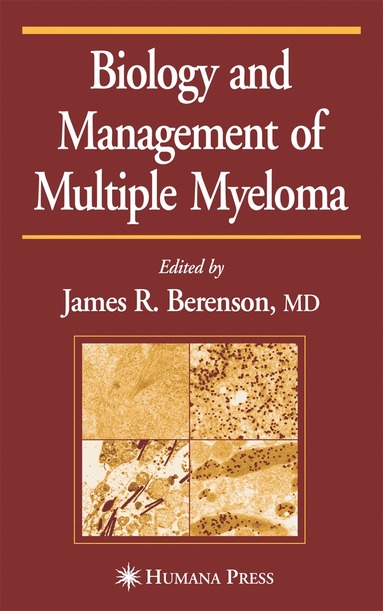 bokomslag Biology and Management of Multiple Myeloma