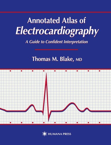 Thomas M. Blake - Annotated Atlas of Electrocardiography, Inbunden