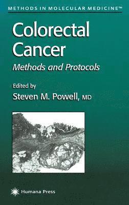 Steven M. Powell - Colorectal Cancer, Inbunden