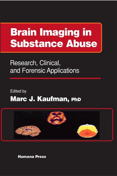 Marc J. Kaufman - Brain Imaging in Substance Abuse, Inbunden