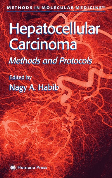 Nagy A. Habib - Hepatocellular Carcinoma, Inbunden
