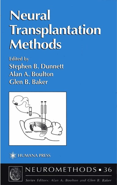 Stephen B. Dunnett, Alan A. Boulton, Glen B. Baker - Neural Transplantation Methods, Inbunden