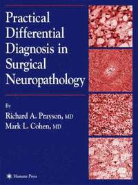 bokomslag Practical Differential Diagnosis in Surgical Neuropathology