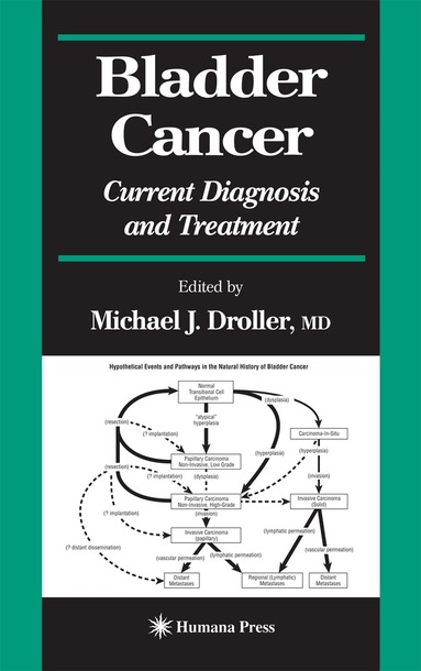 Michael J. Droller - Bladder Cancer, Inbunden