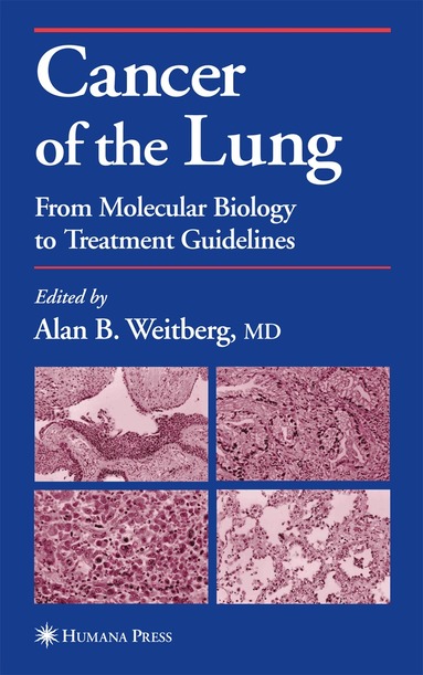 Alan Weitberg - Cancer of the Lung, Inbunden