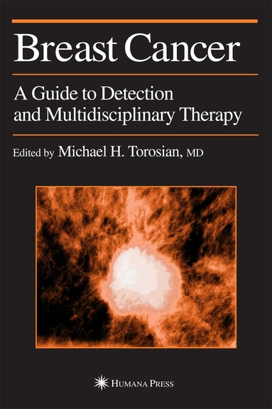 Michael H. Torosian - Breast Cancer, Inbunden