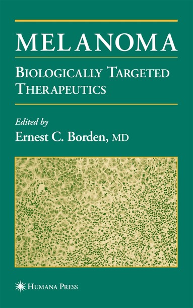 Ernest C. Borden - Melanoma, Inbunden