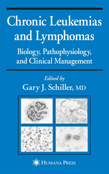 Gary J. Schiller - Chronic Leukemias and Lymphomas, Inbunden