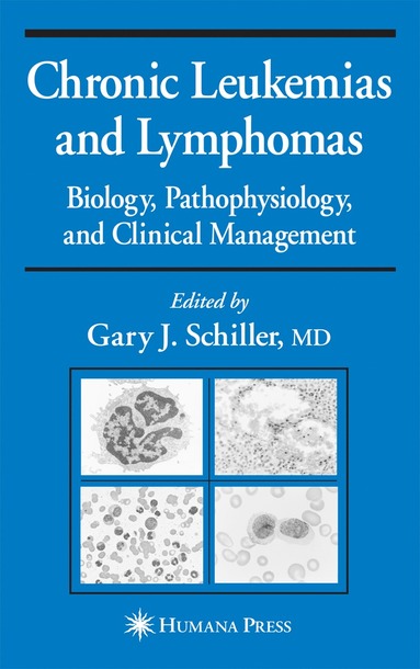 bokomslag Chronic Leukemias and Lymphomas