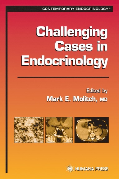 bokomslag Challenging Cases in Endocrinology