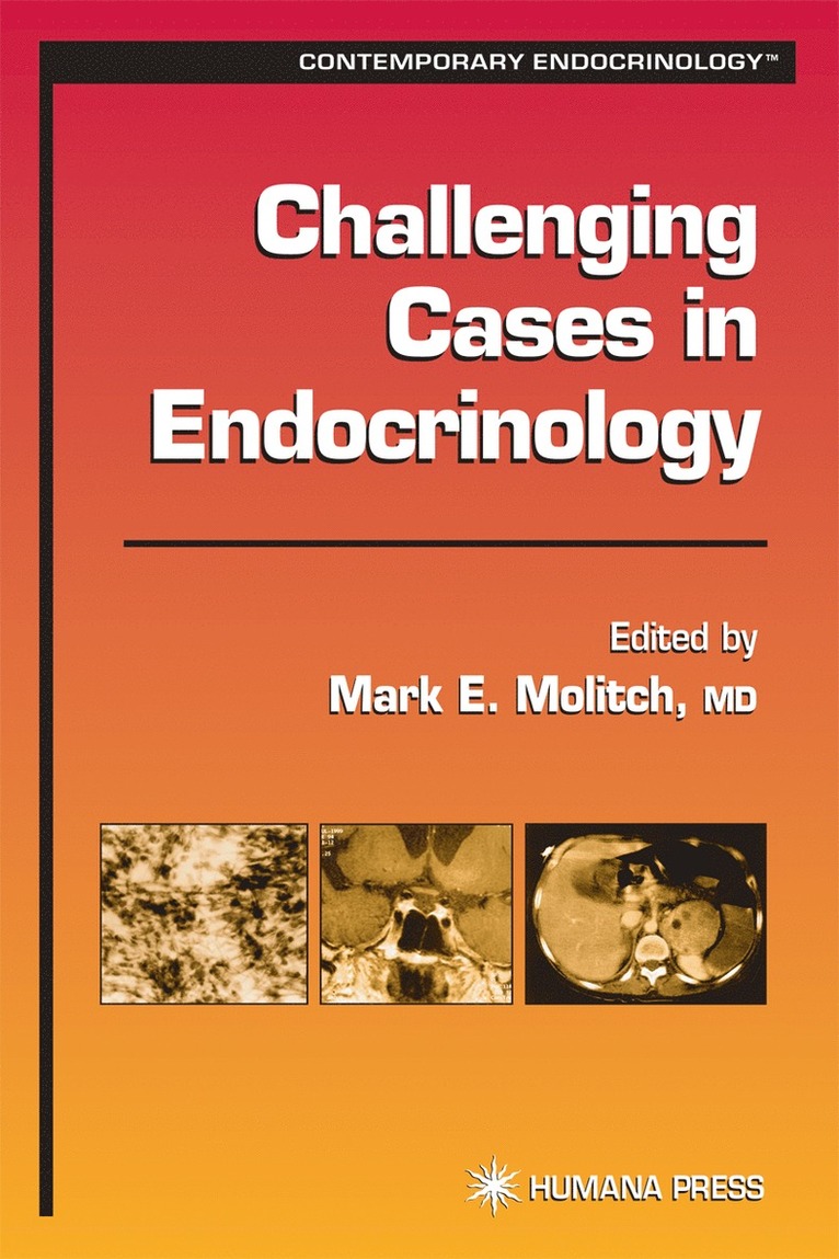 Mark E. Molitch, Mark Molitch, Mark E Molitch - Challenging Cases in Endocrinology, Inbunden