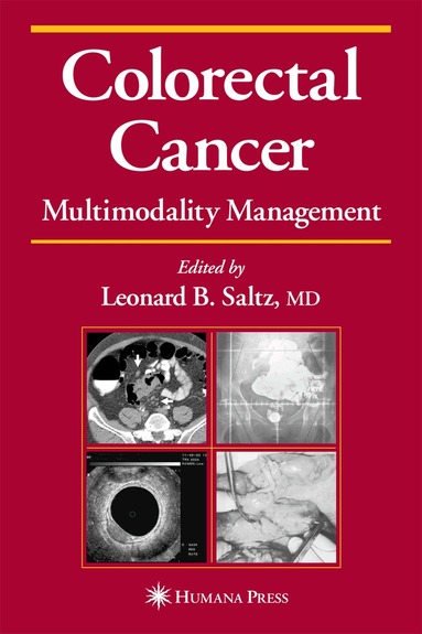 Leonard B. Saltz - Colorectal Cancer, Inbunden