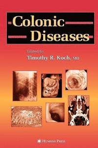bokomslag Colonic Diseases