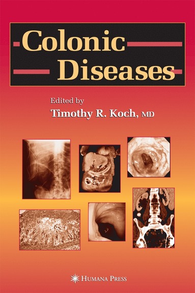 bokomslag Colonic Diseases