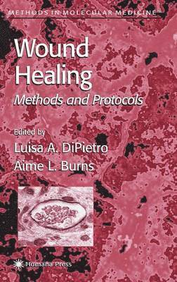 Luisa A. DiPietro, Aime L. Burns, Luisa A. DiPietro, Aime L. Burns - Wound Healing, Inbunden