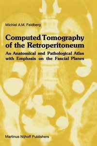 bokomslag Computed Tomography of the Retroperitoneum