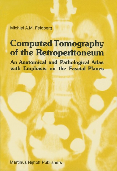 Michiel A.M. Feldberg - Computed Tomography of the Retroperitoneum, Inbunden