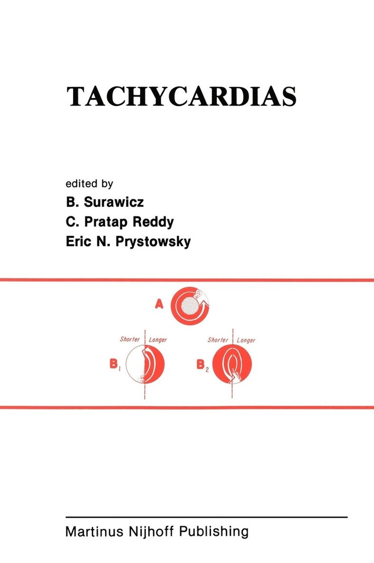 Tachycardias 1