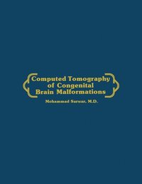 bokomslag Computed Tomography of Congenital Brain Malformations