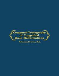 bokomslag Computed Tomography of Congenital Brain Malformations