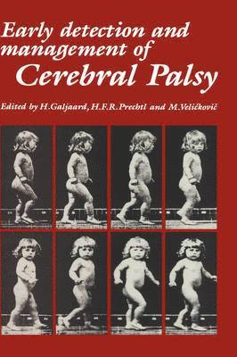 Early Detection and Management of Cerebral Palsy 1