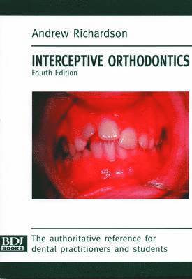 Interceptive Orthodontics