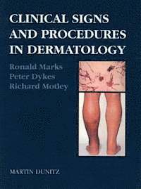 bokomslag Clinical Signs and Procedures in Dermatology