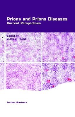 bokomslag Prions and Prion Diseases