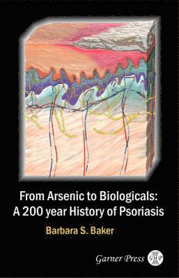From Arsenic to Biologicals: A 200 Year History of Psoriasis 1