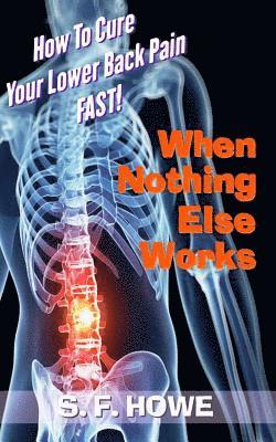 When Nothing Else Works: How To Cure Your Lower Back Pain Fast! 1