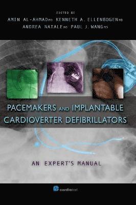 Amin Al-Ahmad, Kenneth Ellenbogen, Andrea Natale - Pacemakers and Implantable Cardioverter Defibrillators, Inbunden