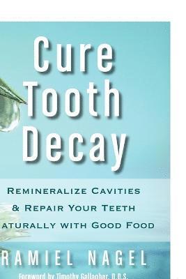 Ramiel Nagel, D D S Timothy Gallagher - Cure Tooth Decay, Häftad