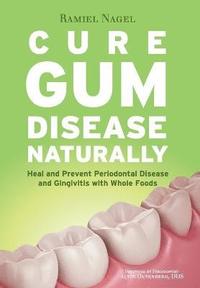 bokomslag Cure Gum Disease Naturally