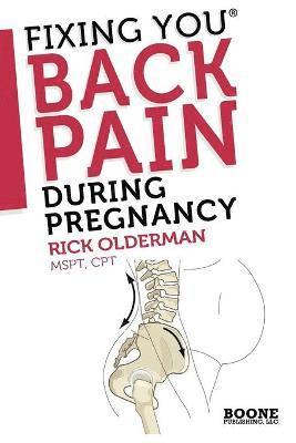 Fixing You: Back Pain During Pregnancy 1