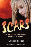 Scars 1