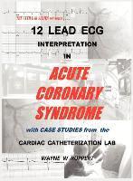 bokomslag 12 Lead ECG Interpretation in Acute Coronary Syndrome with Case Studies from the Cardiac Catheterization Lab