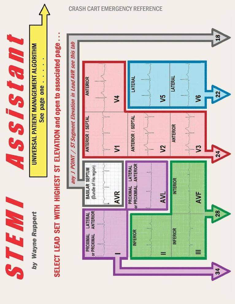 STEMI Assistant 1