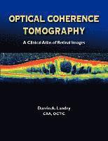 bokomslag Optical Coherence Tomography a Clinical Atlas of Retinal Images