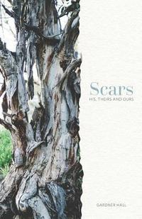 bokomslag Scars: His, Theirs and Ours