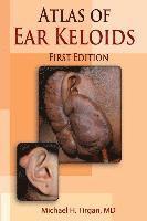 bokomslag Atlas of Ear Keloids
