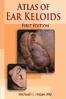 Atlas of Ear Keloids 1