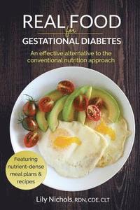 bokomslag Real Food for Gestational Diabetes
