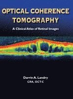 bokomslag Optical Coherence Tomography